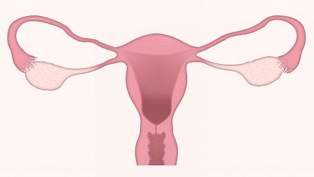 příznaky menopauzy - vaginální suchost